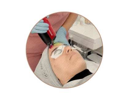 MOSAIC 3D LASER before and after care