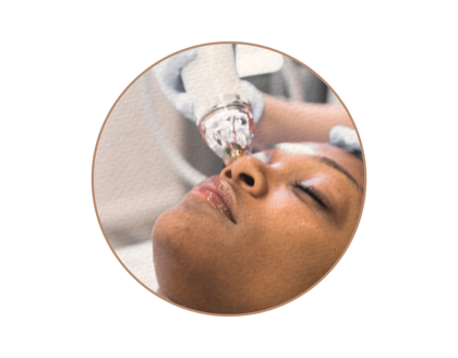 RF MICRONEEDLING before and after care